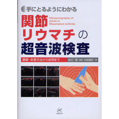 手にとるようにわかる関節リウマチの超音波検査　基礎・走査方法から症例まで