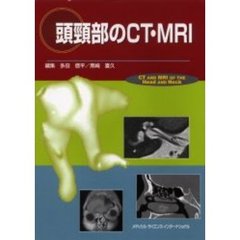 頭頚部のＣＴ・ＭＲＩ