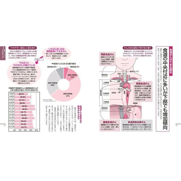 食道がんのすべてがわかる本 新版 通販｜セブンネットショッピング