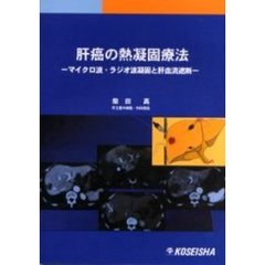 肝癌の熱凝固療法　マイクロ波・ラジオ波凝固と肝血流遮断
