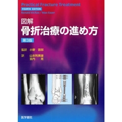 図解骨折治療の進め方　第３版