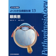眼疾患