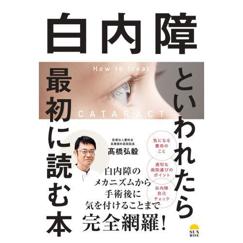 白内障といわれたら最初に読む本