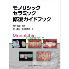 モノリシックセラミック修復ガイドブック