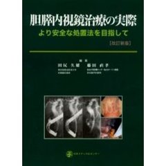 胆膵内視鏡治療の実際　より安全な処置法を目指して　改訂新版
