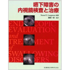 嚥下障害の内視鏡検査と治療