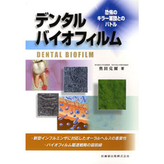 デンタルバイオフィルム　恐怖のキラー軍団とのバトル