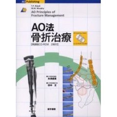 ＡＯ法骨折治療
