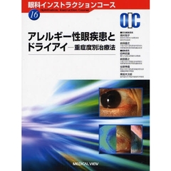 アレルギー性眼疾患とドライアイ　重症度別治療法
