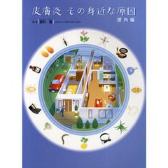 皮膚炎その身近な原因　屋内編