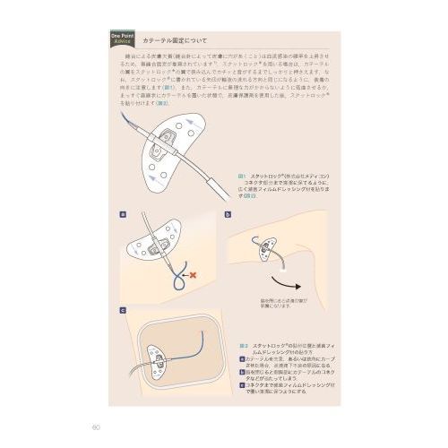 PICCの教科書 失敗しない！挿入から管理までのポイント 通販