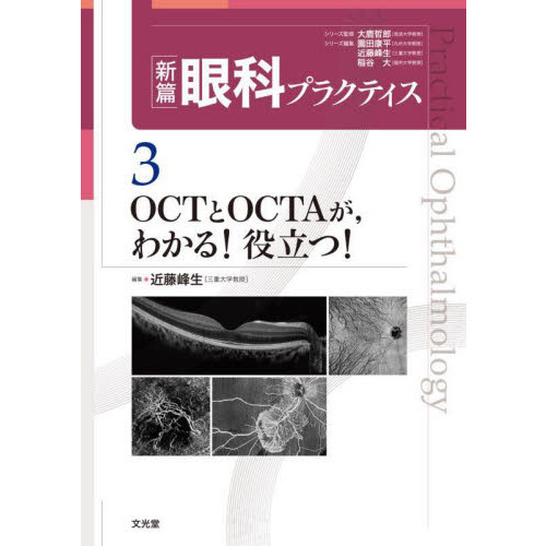 新篇眼科プラクティス ３ ＯＣＴとＯＣＴＡが，わかる！役立つ！ 通販