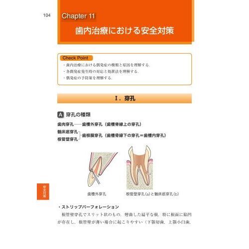 歯科国試パーフェクトマスター歯内治療学