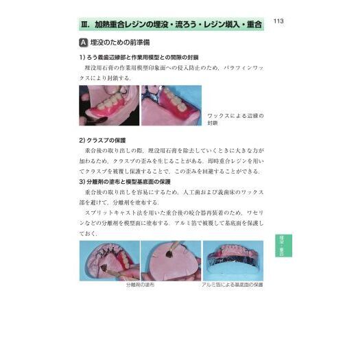 歯科国試パーフェクトマスターパーシャルデンチャー補綴学 第２版 通販｜セブンネットショッピング
