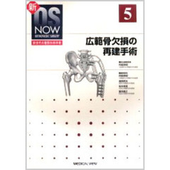広範骨欠損の再建手術