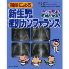 画像による新生児症例カンファランス　どこを見る？何がわかる？