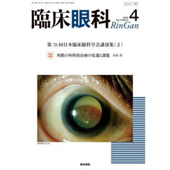 臨床眼科　2025年4月号