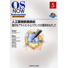 人工膝関節置換術　適切なアライメントとバランスの獲得をめざして