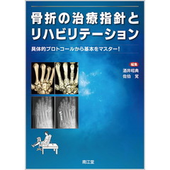 骨折の治療指針とリハビリテーション　具体的プロトコールから基本をマスター！