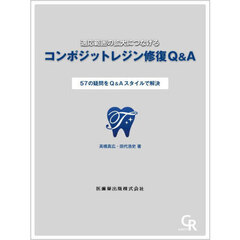 コンポジットレジン修復Ｑ＆Ａ