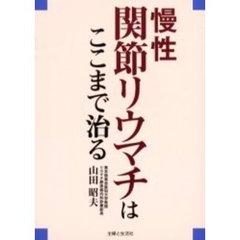 慢性関節リウマチはここまで治る