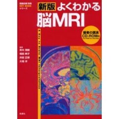 よくわかる脳ＭＲＩ　新版