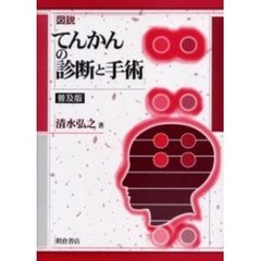 図説てんかんの診断と手術　普及版