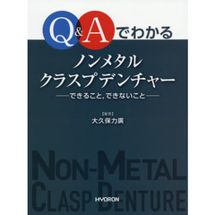 Ｑ＆Ａでわかるノンメタルクラスプデンチャー　できること，できないこと