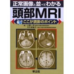正常画像と並べてわかる頭部ＭＲＩ