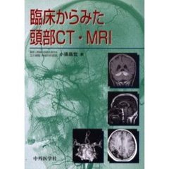 臨床からみた頭部ＣＴ・ＭＲＩ