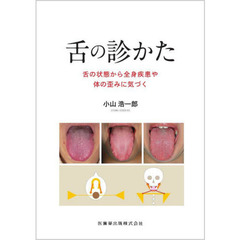 舌の診かた　舌の状態から全身疾患や体の歪みに気づく