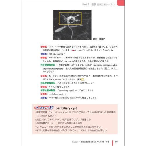 画像診断に絶対強くなるワンポイントレッスン 1-3セット 画像