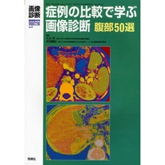 症例の比較で学ぶ画像診断腹部５０選