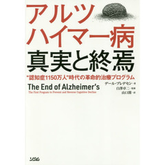 アルツハイマー病 真実と終焉"認知症1150万人"時代の革命的治療プログラム
