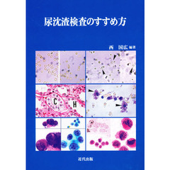 尿沈【サ】検査のすすめ方　「尿沈【サ】検査法」の標準化に向けて