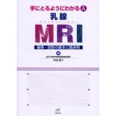 手にとるようにわかる乳腺ＭＲＩ