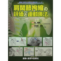 肩関節拘縮の評価と運動療法