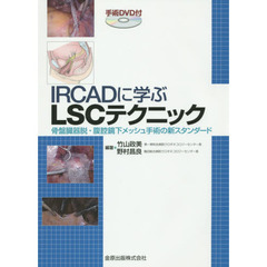 ＩＲＣＡＤに学ぶＬＳＣテクニック　骨盤臓器脱・腹腔鏡下メッシュ手術の新スタンダード