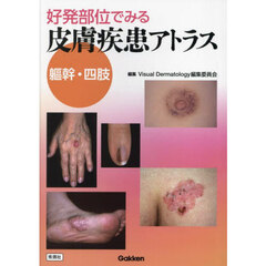 好発部位でみる皮膚疾患アトラス　躯幹・四肢