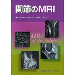 関節のＭＲＩ