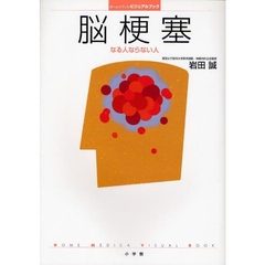 脳梗塞　なる人ならない人
