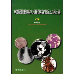 縦隔腫瘍の画像診断と病理