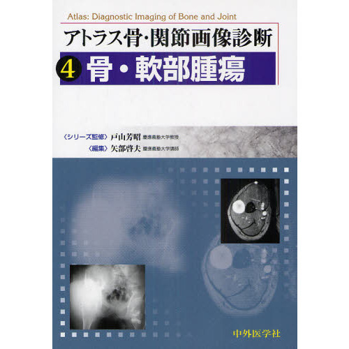 m3電子書籍 | アトラス骨・関節画像診断 4.骨・軟部腫瘍