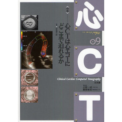 心ＣＴ　０９　〈特集〉心ＣＴは心エコーにどこまで迫れるか