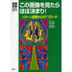 この画像を見たらほぼ決まり！　パターン認識からのアプローチ