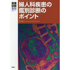 婦人科疾患の鑑別診断のポイント