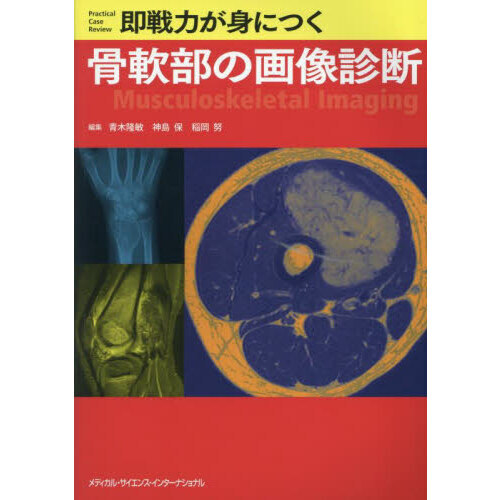 即戦力が身につく骨軟部の画像診断 通販｜セブンネットショッピング