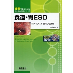 食道・胃ＥＳＤ　ＩＴナイフによるＥＳＤの実際