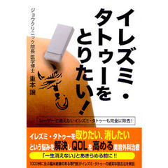 イレズミ・タトゥーをとりたい！　レーザーで消えないイレズミ・タトゥーも完全に除去！
