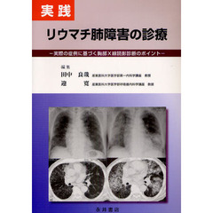 実践リウマチ肺障害の診療　実際の症例に基づく胸部Ｘ線読影診断のポイント
